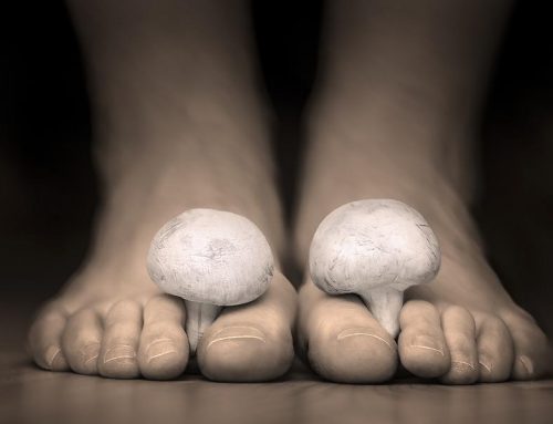 Athlete’s Foot Diagnosis Highlight Of Local Man’s Athletic Achievements
